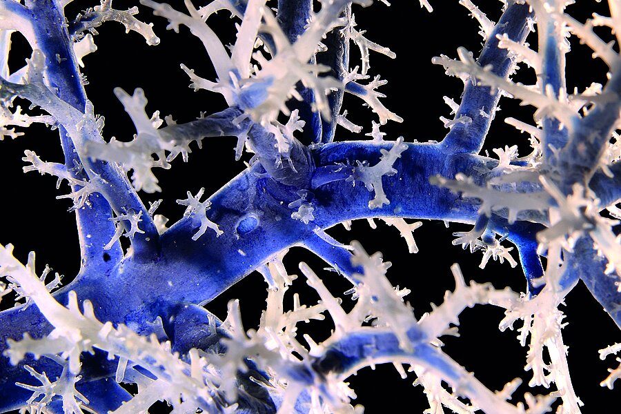 Zu sehen ist eine Nahaufnahme eines großen, blauen Blutgefäßes, das sich zunehmend feiner in weiße Adern verästelt. Zu sehen ist eine Nahaufnahme eines großen, blauen Blutgefäßes, das sich zunehmend feiner in weiße Adern verästelt.